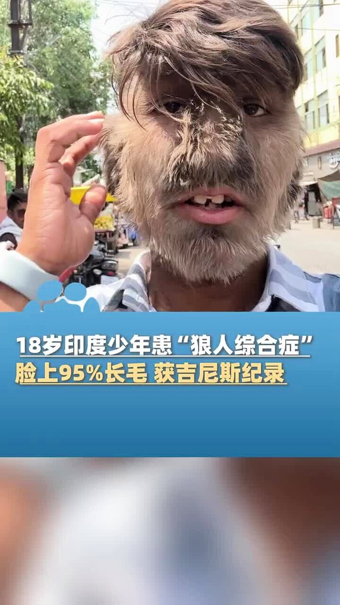 18岁以下禁止观看的网站在线观看的相关介绍
